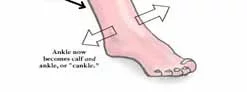Tips for Tackling Cankles